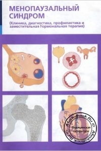 Менопаузальный синдром, Под редакцией В.И. Кулакова, Е.М. Вихляевой, 1996 г. 