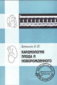 Кардиология плода и новорожденного, Затикян Е.П., 1996 г. 