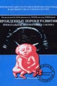 Врожденные пороки развития: Пренатальная диагностика и тактика, Б.М. Петриковский, 1999 г.