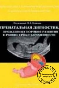 Пренатальная диагностика врожденных пороков развития в ранние сроки беременности, М.Д. Медведев, 2000 г. 