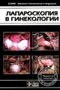 Лапароскопия в гинекологии, Савельев Г.М., 1999 г.