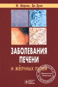 Заболевания печени и жёлчных путей, Шерлок Ш., Дули Дж., 1999 г. 