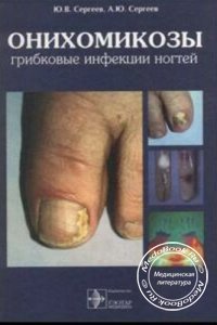 Онихомикозы: Грибковые инфекции ногтей, Сергеев Ю.В., Сергеев А.Ю., 1998 г. 