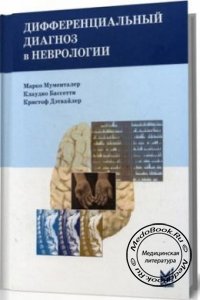 Дифференциальный диагноз в неврологии, Мументалер М., Бассетти К., Дэтвайлер К., 2009 г.