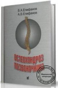Остеохондроз позвоночника, Епифанов В.А., Епифанов А.В., 2004 г.