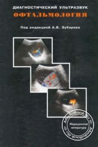 Офтальмология: Диагностический ультразвук, А.В. Зубарев, 2002 г. 