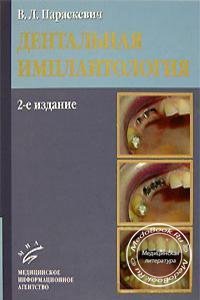 Дентальная имплантология, Параскевич В.Л., 2006 г. 