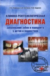 Клинико-рентгенологическая диагностика заболеваний зубов и пародонта у детей и подростков, Хоменко Л.А., Остапко Е.И., Биденко Н.В., 2004 г.