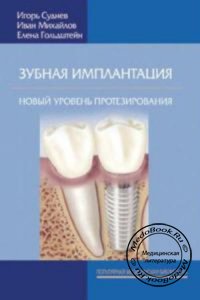 Зубная имплантация: Новый уровень протезирования, И. Суднев, И. Михайлов, Е. Гольдштейн, 2007 г.