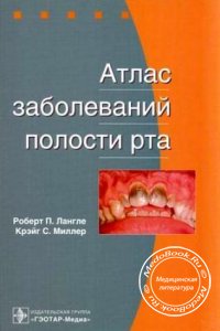Атлас заболеваний полости рта, Лангле Роберт П., Миллер Крэйг С., 2008 г.