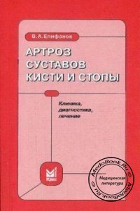 Артроз суставов кисти и стопы, В.А. Епифанов, 2005 г.