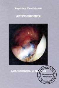 Артроскопия: Диагностика и терапия, Хемпфлинг Х., 1990 г. 