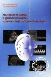 Ультрасонография и допплерография в диагностике заболеваний почек, Квятковский Е.А., 2005 г. 