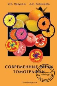 Современные виды томографии, Марусина М.Я., Казначеева А.О., 2006 г.