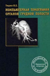 Компьютерная томография органов грудной полости, Тюрин И.Е., 2003 г.
