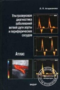 Атлас: Ультразвуковая диагностика заболеваний ветвей дуги аорты и периферических сосудов, Агаджанова Л.П., 2004 г.