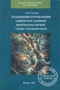 Ультразвуковая допплерография в диагностике поражений магистральных артерий головы и основания мозга, Никитин Ю.М., 1995 г.