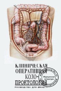 Клиническая оперативная колопроктология, В.Д. Федоров, 1994 г.