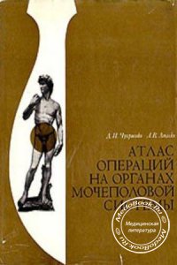 Атлас операций на органах мочеполовой системы, Чухриенко Д.П., 1972 г.