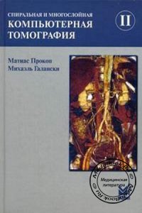 Спиральная и многослойная компьютерная томография: Том 2, Матиас Прокоп, Михаэль Галански, 2008 г.