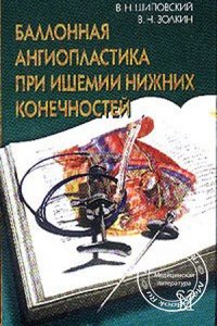 Баллонная ангиопластика при ишемии нижних конечностей, Затевахин И.И., Шиповский В.Н., 2004 г.