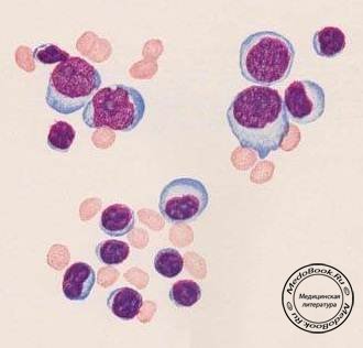Клетки лимфоцитарного ряда