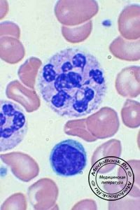 Мегалобласты: Клетки эритроцитарного ряда