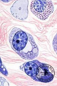 Плазматические клетки: Производные ретикулоэндотелиальной системы