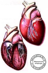 Этиология дилатационной кардиомиопатии