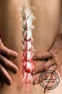 Безопасные методики лечения спины