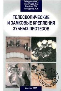 Телескопические и замковые крепления зубных протезов, Лебеденко И.Ю., Перегудов А.Б., 2005 г.