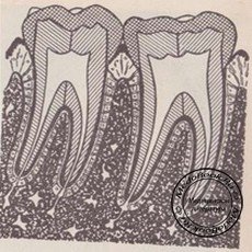 Схема изменений, происходящих при старении в тканях зуба и периодонта - строение зубов и периодонта у молодого человека