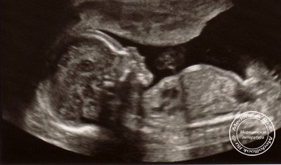УЗИ на третьем триместре беременности