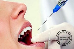 Применение бенкаина в стоматологии с целью проведения местной анестезии