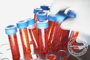 Биохимический анализ крови важен для оценки метаболических процессов в организме