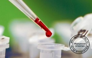 Общий анализ крови важен для оценки клеточного состава крови