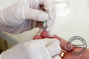 Взятие анализа крови у пациента специальным медицинским инструментом - скарификатором