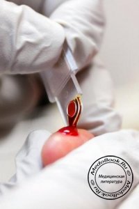 Общий и биохимический анализы крови