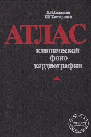 Атлас клинической фонокардиографии, В.В. Соловьев, Г.И. Кассирский, 1983 г.