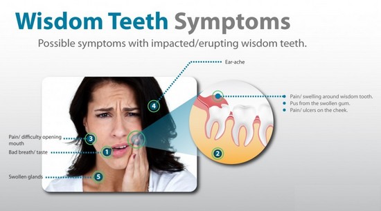 Симптомы заболеваний зуба мудрости