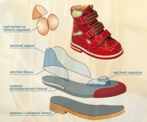 Ортопедическая обувь для детей с плосковальгусной деформацией стопы