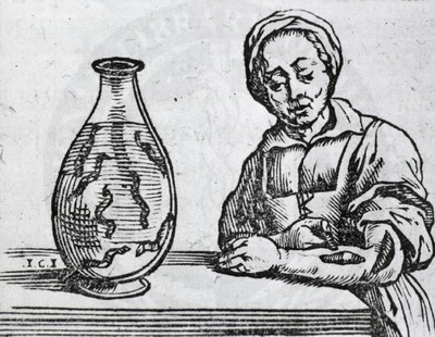 Лечение пиявками на гравюре 17 века. Иллюстрация в книге «Bossche van den Guillaume» 1639 г.