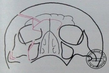 Схема к полуаксиальному рентгеновскому снимку перелома лобной кости, верхней челюсти и скуловой дуги
