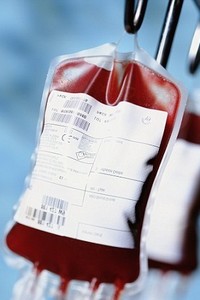 Переливание фибринолизной крови больным с ЧМТ при проведении нейрохирургических операций
