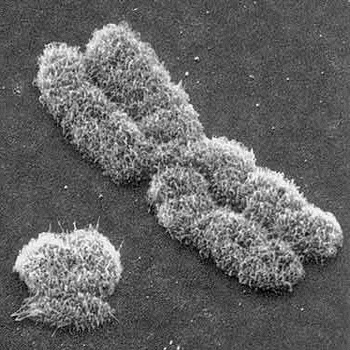 Микрофотография X и Y хромосом