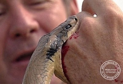 Укус змеи может быть смертельный