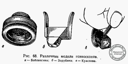 Различные модели гониоскопов: Бойнингена, Зарубина, Краснова