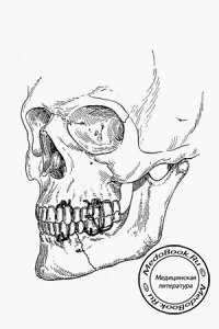 Закрепление отломков челюсти лигатурным связыванием