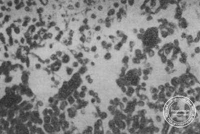 ШИК-положительные макрофаги в синусе мезентериального лимфатического узла