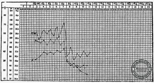 Кривая пульса (Р), температуры (KW) и дыхания (А)